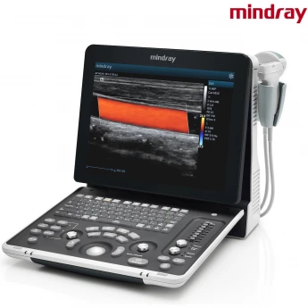 Аппарат УЗИ MINDRAY Z60 Exp начального класса